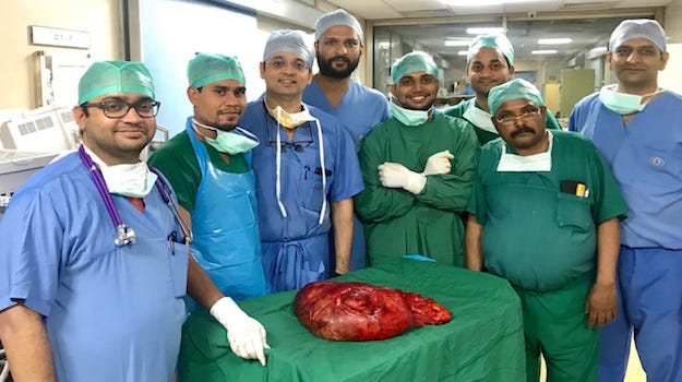 Weighing scale fell short for the huge tumor, removed successfully at Sir Ganga Ram Hospital 