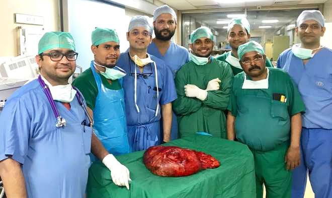 After 10-hr surgery, docs remove 10-kg tumour from farmer's stomach